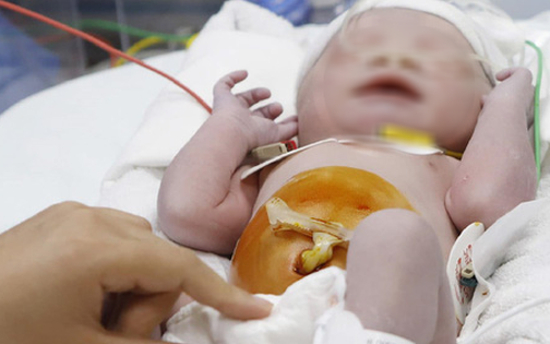 Cần thiết xây dựng kế hoạch hành động quốc gia về bệnh tim bẩm sinh- Ảnh 6.