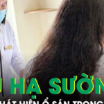 Phát hiện ổ sán làm tổ trong gan từ dấu hiệu đau hạ sườn phải kéo dài