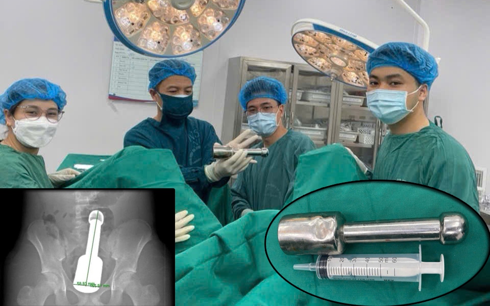 Vùng kín lở loét vì đắp thuốc lá dân gian chữa ngứa- Ảnh 3.