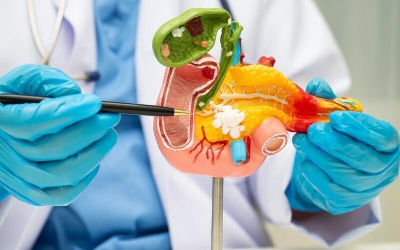 ‘Vũ khí bí mật’ giúp bệnh nhân chiến thắng ung thư tụy sau 6 năm