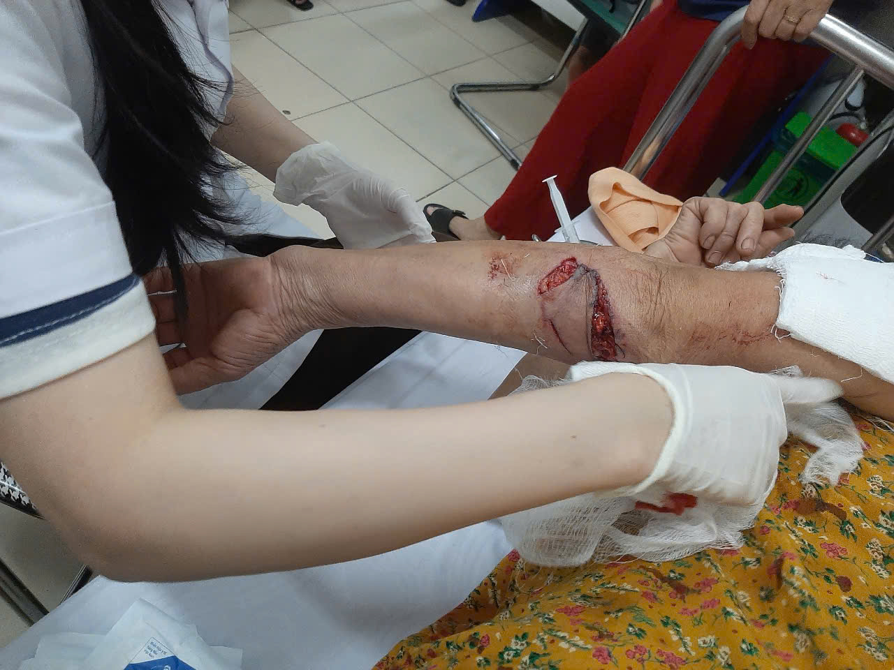 Cảnh giác bệnh dại tăng cao mùa nắng nóng- Ảnh 2.