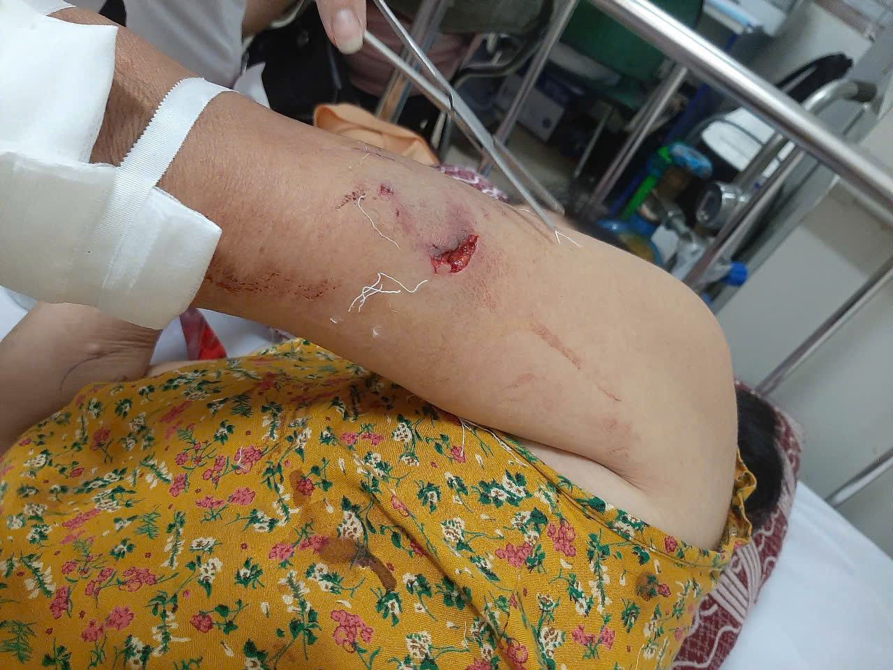 Cảnh giác bệnh dại tăng cao mùa nắng nóng- Ảnh 3.