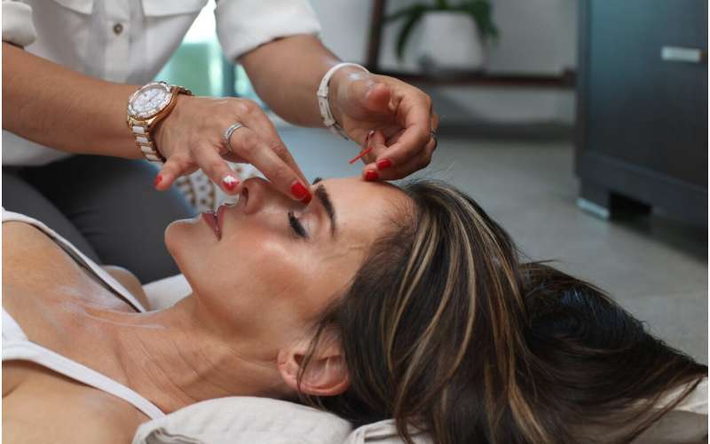 Châm cứu có thể giúp giảm cơn đau đầu căng thẳng mãn tính