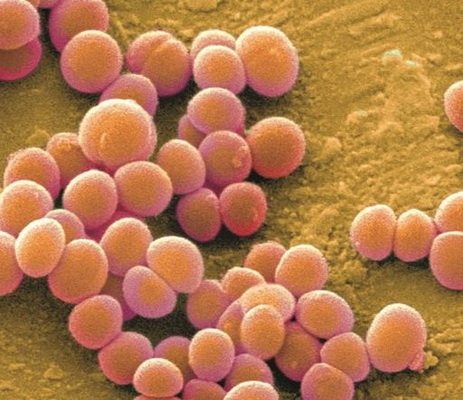 Chớ chủ quan với chín mé ngón tay