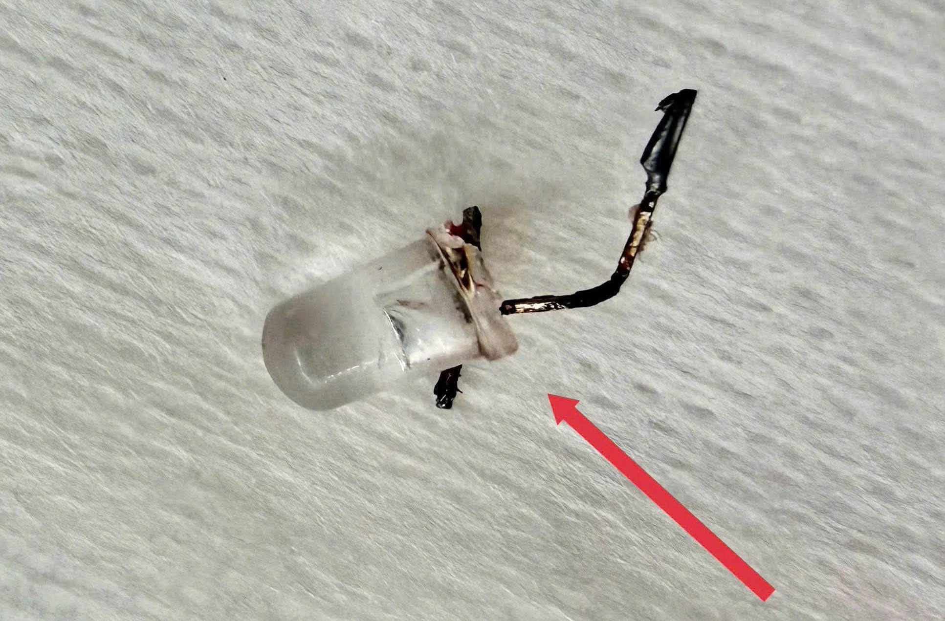 Bé 9 tháng tuổi sặc bóng đèn LED, nhập viện nguy kịch- Ảnh 2.