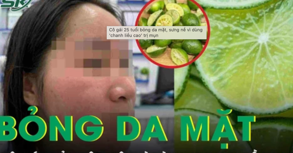 Bộ Y tế đề xuất phạt đến 30 triệu khi phát tán cách chữa bệnh kiểu ‘nhịn ăn, chanh liều cao’