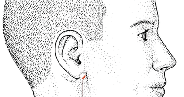 5 huyệt đạo giúp giảm chóng mặt, ù tai