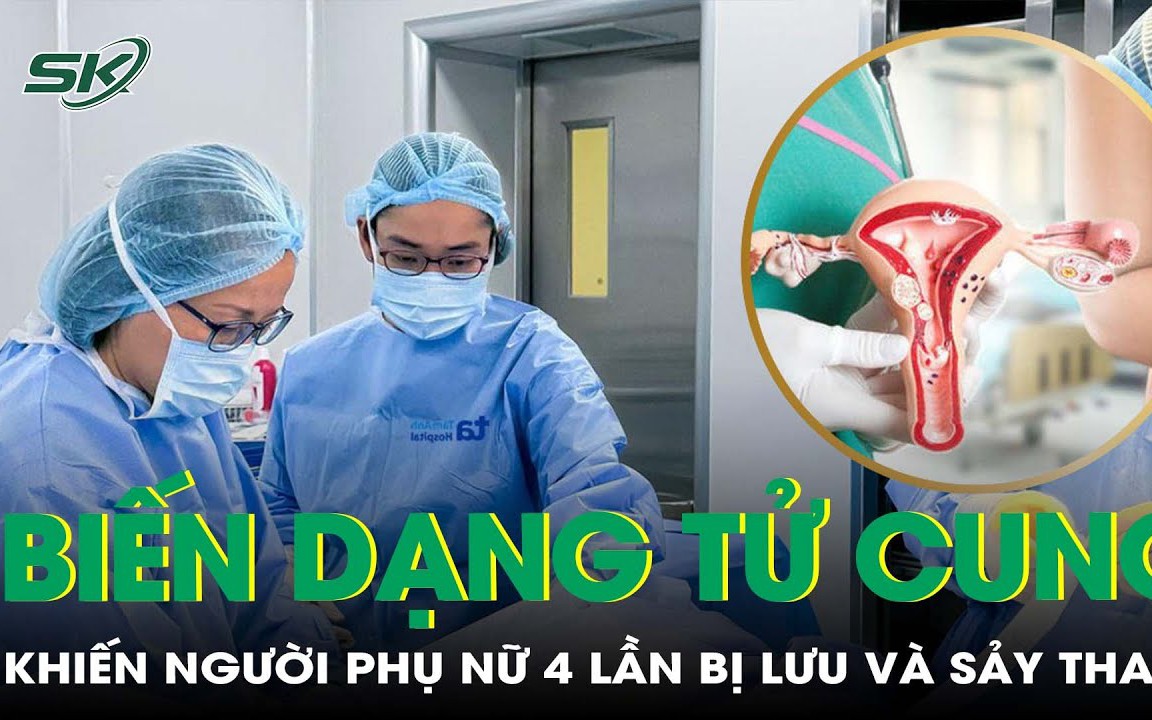 Biến dạng tử cung khiến người phụ nữ sảy thai 4 lần