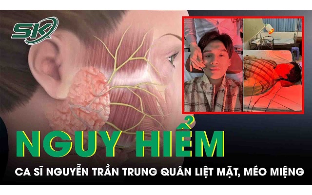 Ca sĩ Nguyễn Trần Trung Quân gặp triệu chứng liệt dây thần kinh số 7, méo miệng