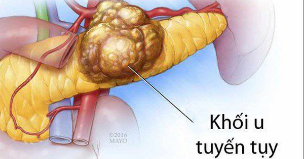 Các phương pháp điều trị u đầu tụy