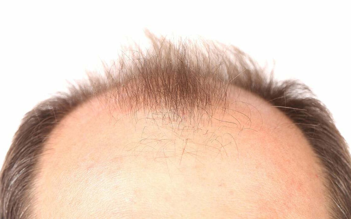 3 công dụng làm đẹp bất ngờ của đường mía thô- Ảnh 3.