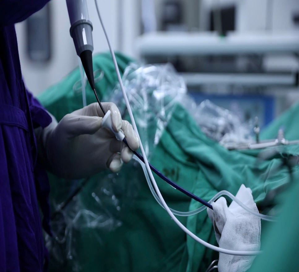 Cách tán sỏi thận không sẹo mổ- Ảnh 3.