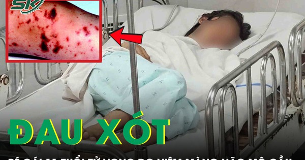 Đau xót: Bé gái 11 tuổi tử vong do viêm màng não mô cầu thể tối cấp