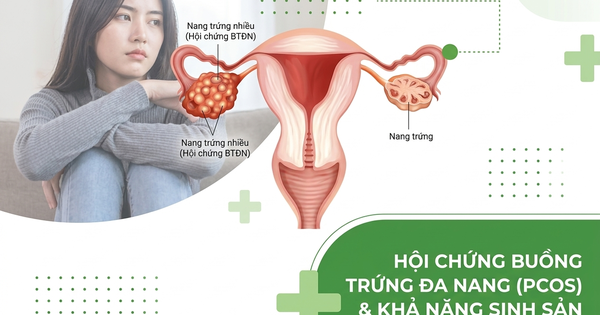 4 cách cải thiện khả năng sinh sản ở phụ nữ mắc Hội chứng buồng trứng đa nang