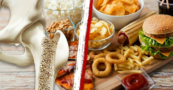 5 nhóm thực phẩm cần tránh khi bị loãng xương