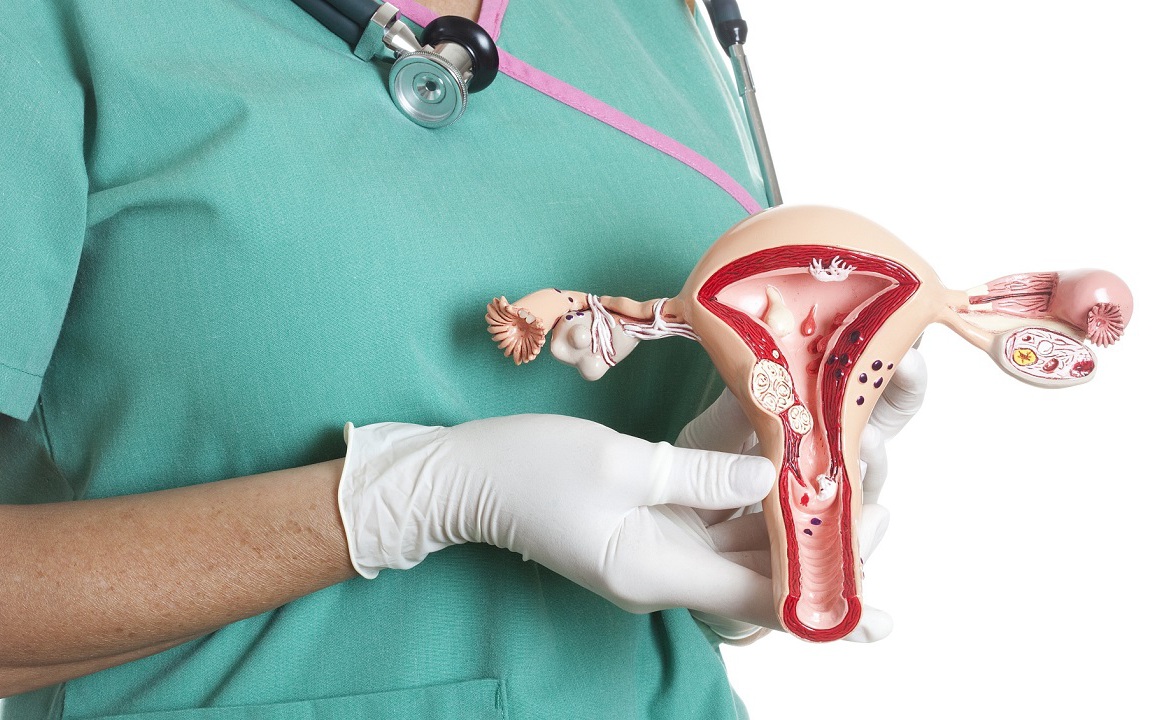 Viêm cổ tử cung: những biến chứng đe dọa sức khỏe sinh sản và cách điều trị dứt điểm