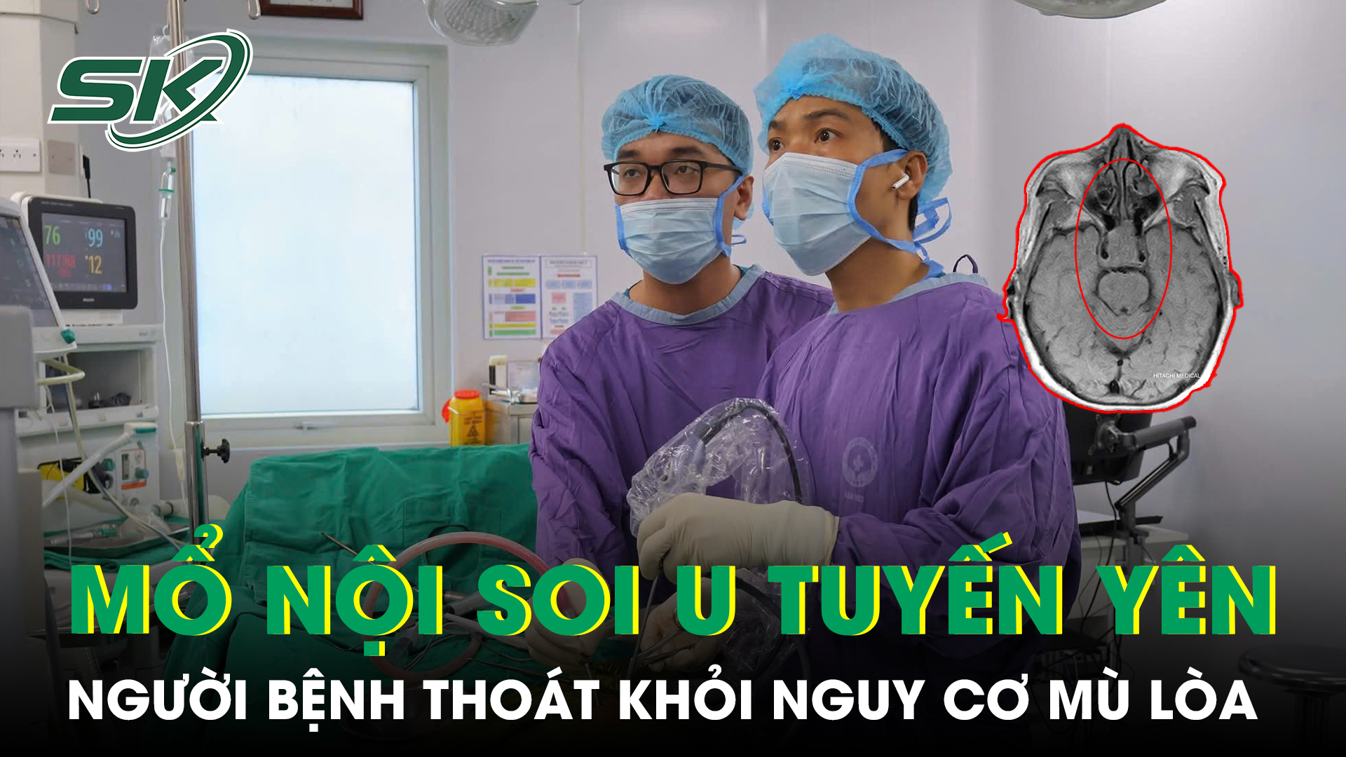 Thoát khỏi nguy cơ mù lòa nhờ phẫu thuật nội soi u tuyến yên - Ảnh 1.