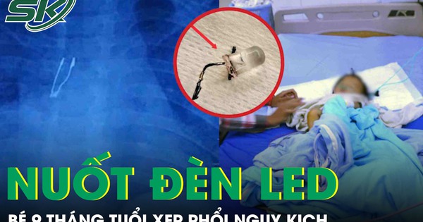 Kinh hoàng: Bé 9 tháng tuổi xẹp phổi vì nuốt bóng đèn LED