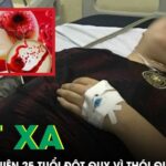 Xót xa: Nam thanh niên 25 tuổi đột quỵ vì thói quen phổ biến giới trẻ