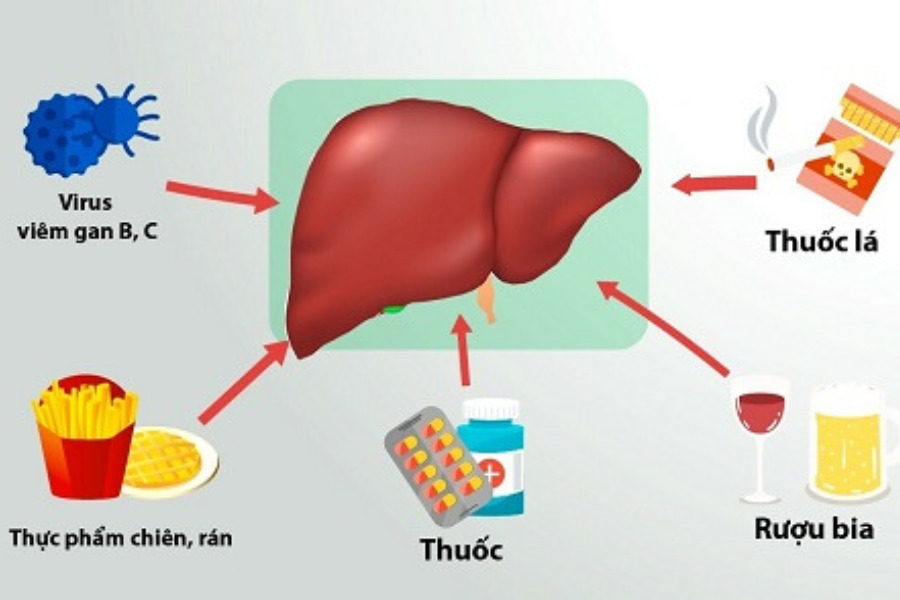 Ăn uống thế nào để giảm men gan tự nhiên?- Ảnh 2.