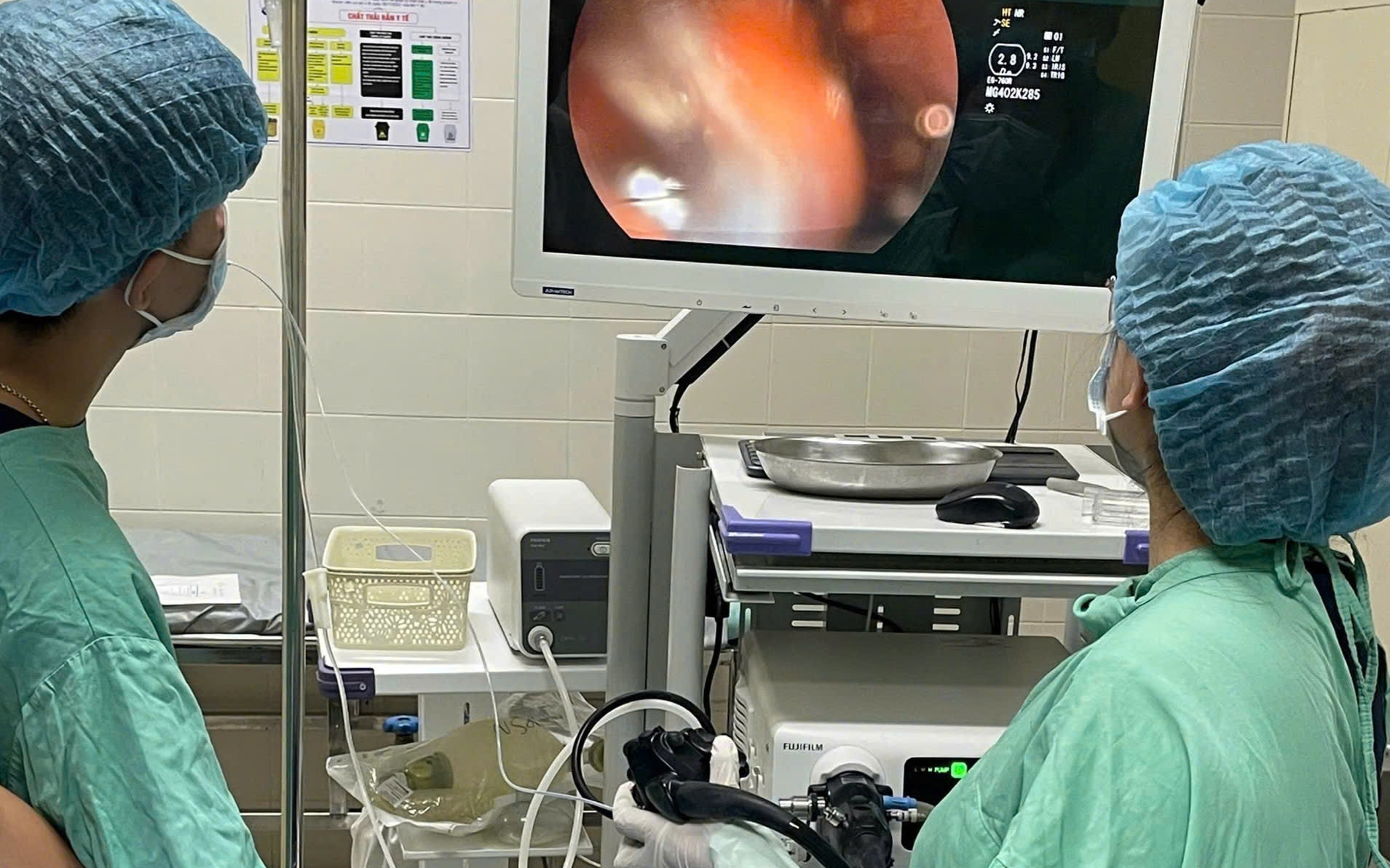 Bé 9 tháng tuổi sặc bóng đèn LED, nhập viện nguy kịch- Ảnh 3.