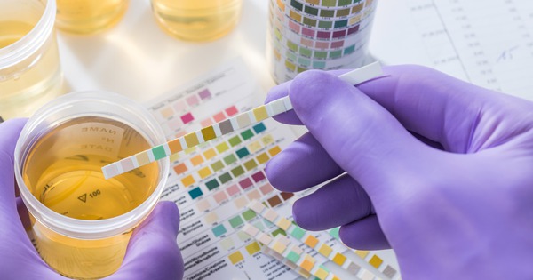 Cảnh giác đi tiểu liên tục dù không uống nhiều nước: đừng nhầm tưởng là suy thận