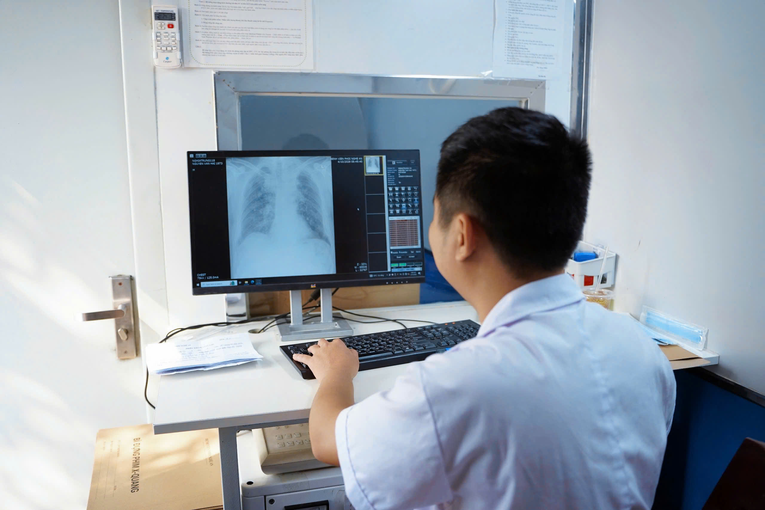 Sàng lọc cộng đồng tại Nghệ An phát hiện 171 ca nghi mắc bệnh lao- Ảnh 5.