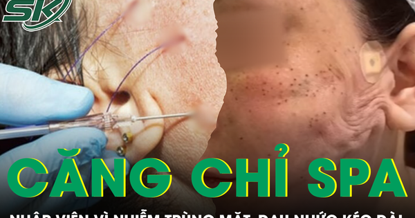 Căng chỉ nâng cơ ở spa, người phụ nữ nhập viện vì nhiễm trùng mặt