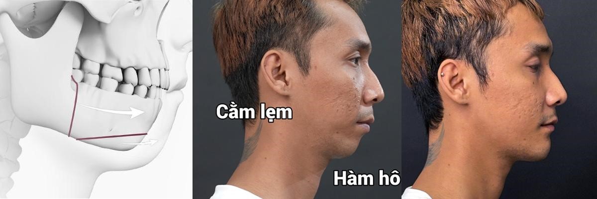 Fan ruột Sơn Tùng M-TP 'lột xác' để theo đuổi visual nghệ sĩ- Ảnh 2.