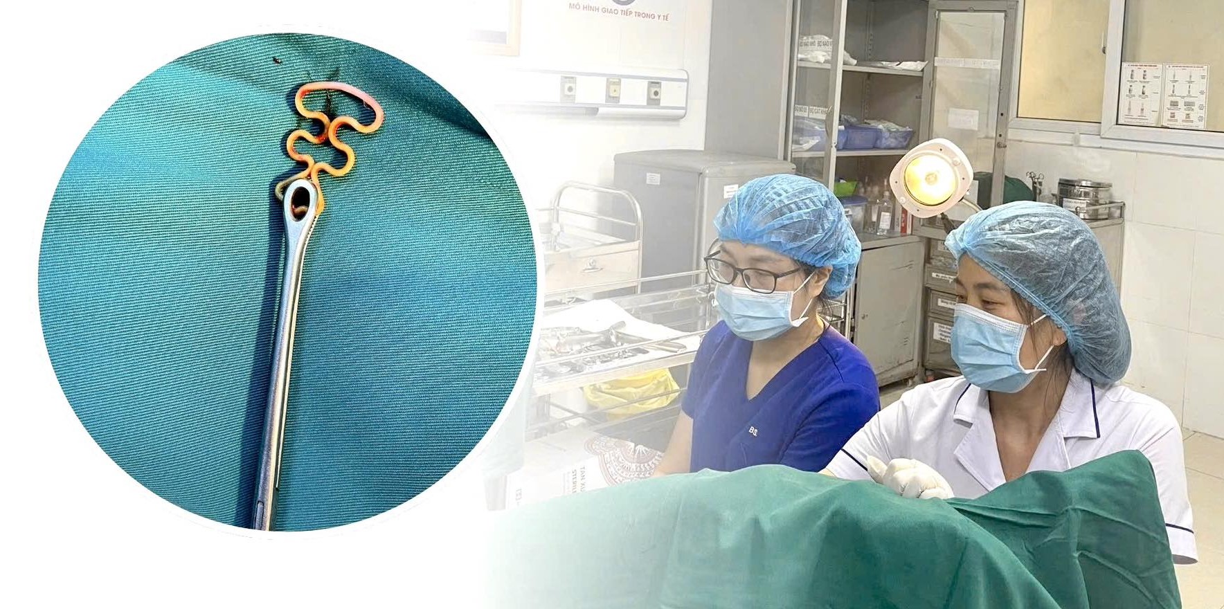Bỏ quên vòng tránh thai suốt 30 năm, người phụ nữ 63 tuổi gặp biến chứng phụ khoa
- Ảnh 1.