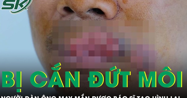 Người đàn ông bị cắn mất môi phải trải qua ca tạo hình phức tạp
