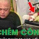 Đại úy công an bị chém tại trụ sở đã được nối lại bàn chân và phẫu thuật sọ não