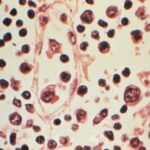 Đài Loan (Trung Quốc) ghi nhận 1 ca tử vong do nhiễm virus Hanta