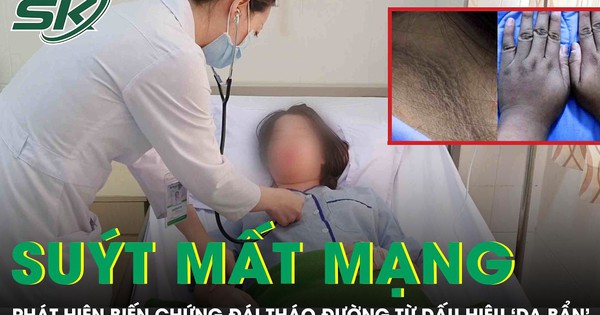 Tưởng da bẩn, cô gái 20 tuổi suýt mất mạng vì biến chứng đái tháo đường
