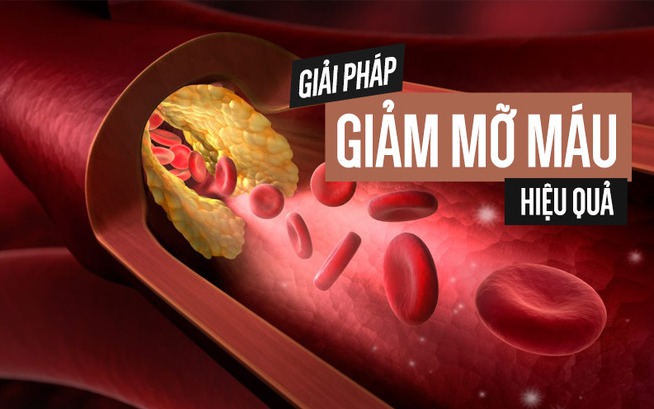 Omega-3 có tác dụng gì trong điều trị mỡ máu?- Ảnh 2. Thực phẩm tốt cho người mỡ máu cao