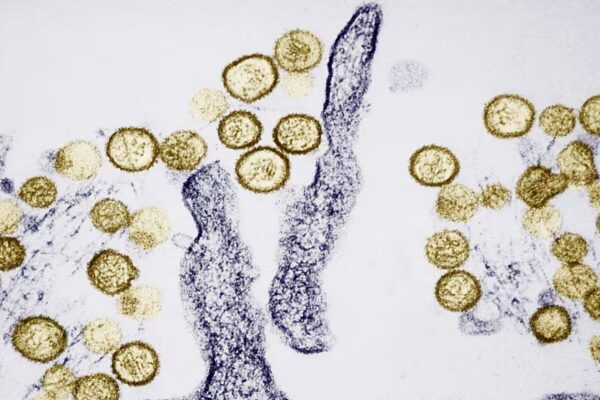 Hantavirus khiến 3 người trên du thuyền MV Hondius tử vong nguy hiểm ra sao?