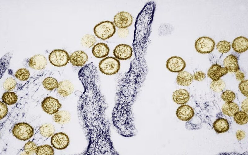 Hantavirus khiến 3 người trên du thuyền MV Hondius tử vong nguy hiểm ra sao?