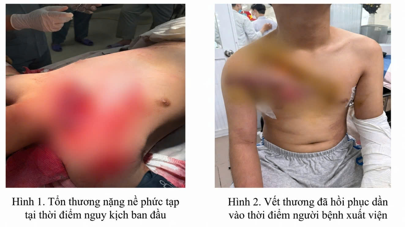 Bộ đôi ‘báo động đỏ liên viện’ và bác sĩ luân phiên cứu nhiều ca nguy kịch ở TPHCM- Ảnh 2. Bộ đôi ‘báo động đỏ liên viện’ và bác sĩ luân phiên cứu nhiều ca nguy kịch ở TPHCM- Ảnh 2.