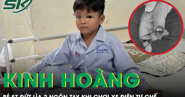 Kinh hoàng: Bé trai 5 tuổi đứt lìa 2 ngón tay khi chơi xe điện tự chế