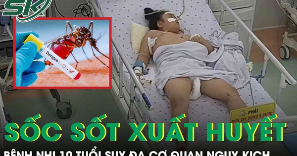 Sốc sốt xuất huyết, bệnh nhi 10 tuổi suy đa cơ quan, tổn thương gan cấp tính nguy kịch
