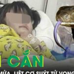 Rắn cắn khi đang ngủ, bé gái 5 tuổi nôn mửa, liệt cơ suýt tử vong