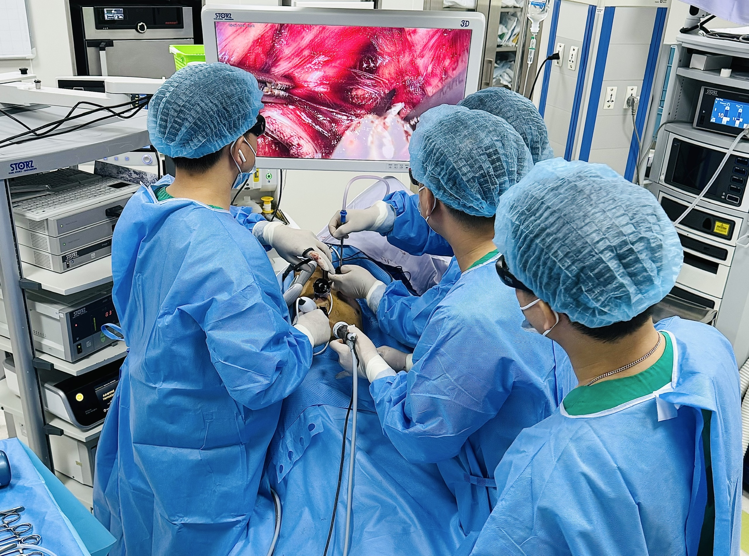Bệnh viện K mổ nội soi 3D thành công hai ca ung thư thực quản phức tạp- Ảnh 1.