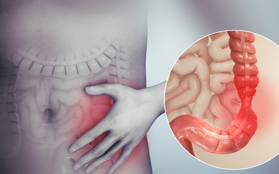 Tiêu chảy kéo dài coi chừng bệnh viêm ruột nguy hiểm- Ảnh 1.