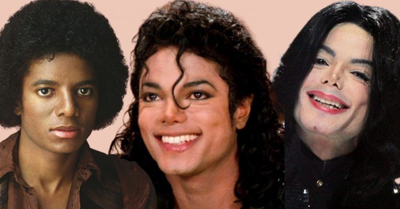 Sự thật về căn bệnh hiếm khiến Michael Jackson phải tẩy trắng da