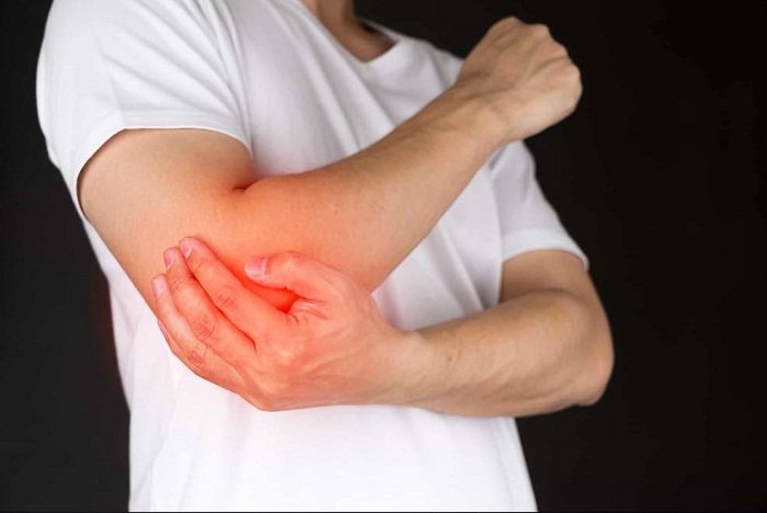 Đau nhức khuỷu tay cảnh báo những bệnh lý nào?- Ảnh 2.