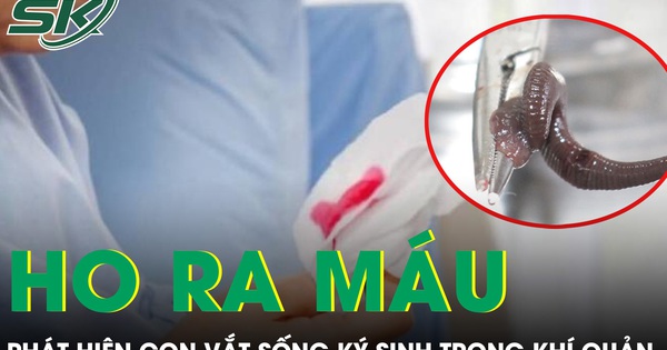 Ho ra máu suốt một tháng, bàng hoàng phát hiện con vắt sống ký sinh trong khí quản