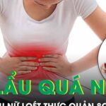 Người phụ nữ loét thực quản 8cm vì thói quen ăn lẩu quá nóng