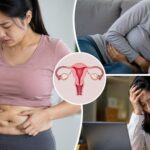 Vì sao nhiều phụ nữ ăn ít vẫn tăng cân và đau vùng chậu kéo dài?