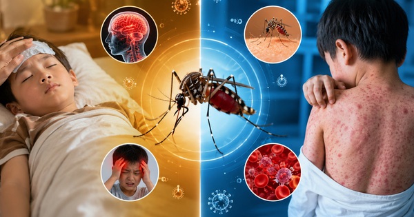 Đừng xem nhẹ những cơn sốt mùa hè