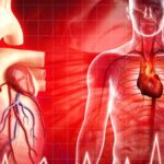 Mỡ máu cao – ‘kẻ giết người thầm lặng’ không gõ cửa báo trước